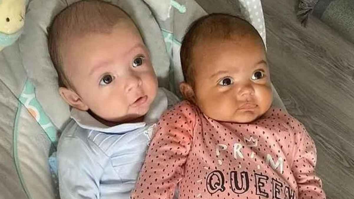 بريطانية تنجب توأمين بلونى بشرة مختلفين بسبب طفرة وراثية نادرة- صور