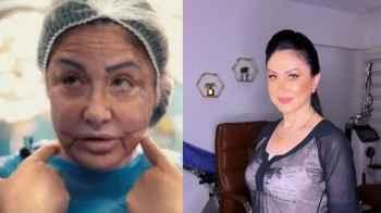 بعد إجرائها عملية تجميل فاشلة.. وفاء سالم تفاجئ المتابعين بملامحها- صور