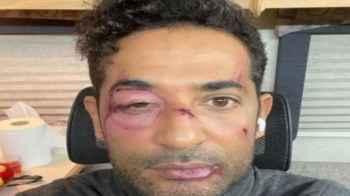 صورة للفنان عمرو سعد تشعل مواقع التواصل