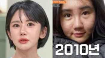 South Korean Woman Spends Over $210,000 on 400 Plastic Surgeries in 15 Years