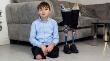 Boy runs campaign to help children after losing legs due to parents