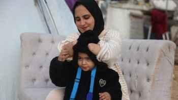 Images That Mirror the World… The Wounds of War on a Mother’s Body and Unyielding Steadfastness