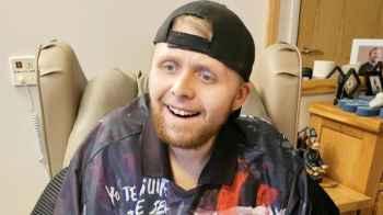 Youngest dementia patient dies in rare case at 24