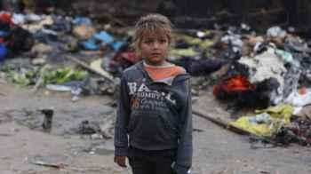 A candle lit for warmth turns into a tragedy… she stood amid the horrors of suffering, pleading with fate