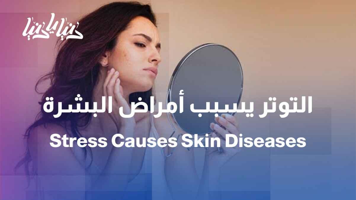 When your skin translates your stress... inflammations and viruses appear on the skin