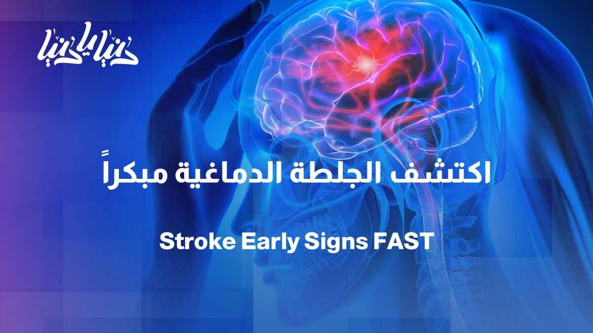 Before it’s too late... How do you detect a stroke?