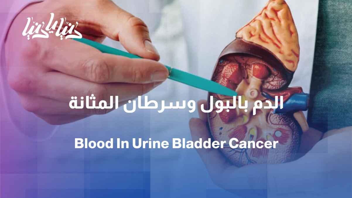 Blood in the urine... When is it a warning sign of bladder cancer?