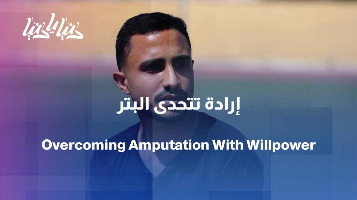 The amputation of his leg was not an obstacle to his ambition.