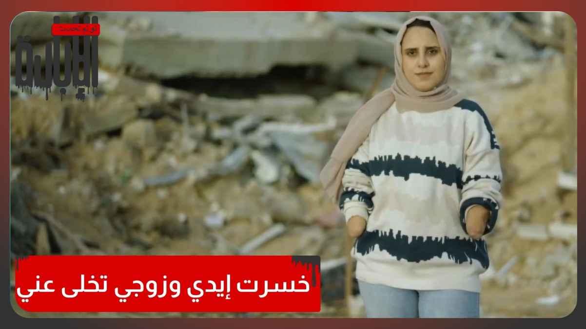 I lost my hands and my husband abandoned me.