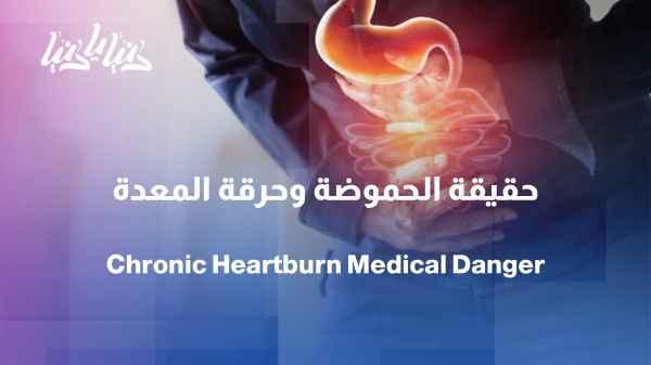 Frequent heartburn: When is it a passing symptom and when does it become a problem? - Ask a specialist