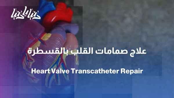 Heart valve replacement via catheterization: A modern treatment without open surgery
