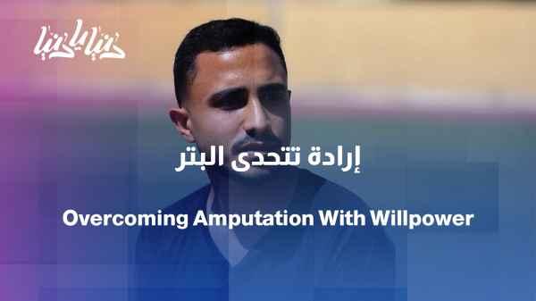 The amputation of his leg was not an obstacle to his ambition.